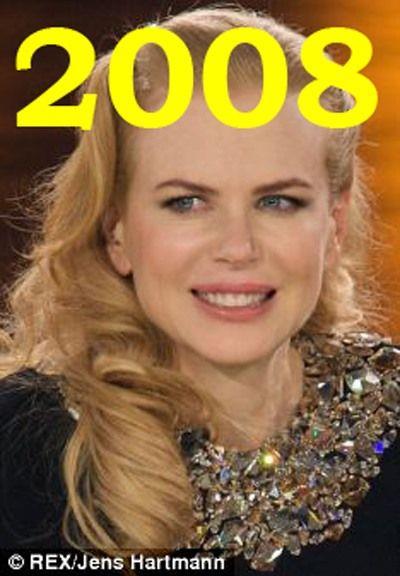 Hollywood'un en gzel aktristlerinden Nicole Kidman'n 20 yllk deiimi haber oldu.