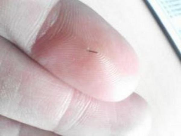 Parmaga batan kiymik