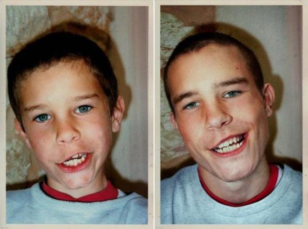 Sosyal medyada yeni trend: Bu kez kullanclar ocukluk fotoraflarnda verdii pozun birebir aynsn yllar sonra veriyor. Bylelikle ortaya ilgin kareler kyor...