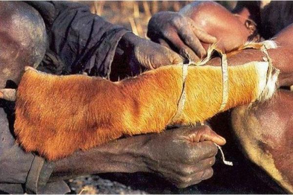 1.Y�rekli birisinin koluna s�k�ca hayvan derisi ba�lan�r.