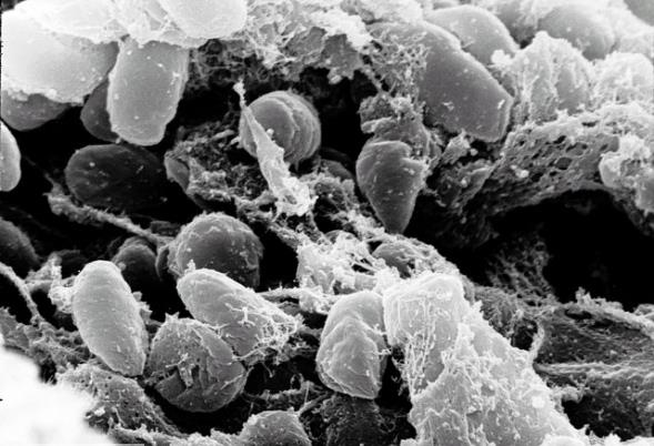 Vebann balad yer tam olarak bilinmemektedir. Baz tarihiler vebann 1320-1330 arasnda in veya Asya`dan balayp askerler ve tccarlar tarafndan Rusya`ya tandna inanrken bazlar ise Rusya`nn gneyinde baladna inanyor.