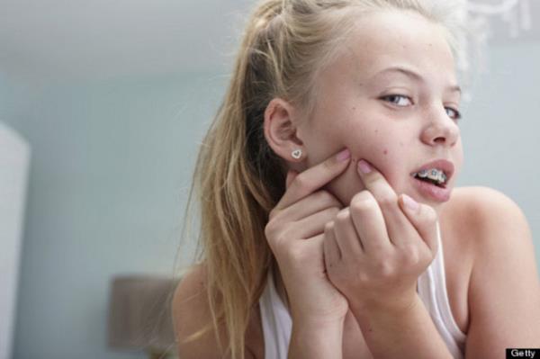 Muhtemelen sivilcerinizle tamamen yanl bir ekilde mcadele ediyorsunuz!