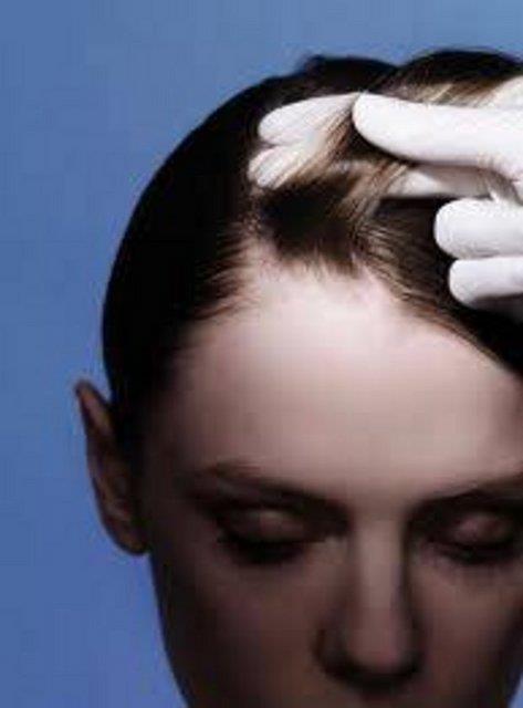 Defne sabunu sa diplerindeki gzenekleri aar ve sa dibi tahrilerini onarrc etki gsterir.