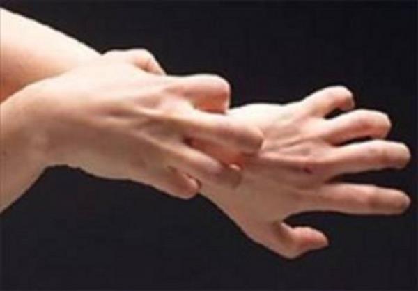 <p><b>HASTALIIN BELRTLER:</b></p>   Deride pembe kzarklklar, ciltte 1 ile 10 cm aras dkntler, ksa zamanda ilie dnen cilt kzarklklar.