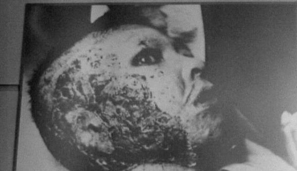 <p><b>BAKALIM BU KEHANETLER GEREKLEECEK M?</b></p>    2014- Kimyasal savan bitmesiyle dnyadaki insanlarnn ou deri kanseri olacaklar veya deriye bal hastalklar olacak...