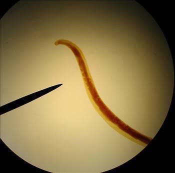 Kan emici barsak kurtlar, dnyada 700 milyon insanda var.