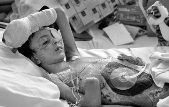 <p><b<Aslan Kalp Operasyonu (Deanne Fitzmaurice):</b></p>   Deanne Fitzmaurice'in ektii bu fotoraf 2005 ylnda Pulitzer dlne layk grlmtr. Fotorafn adn ?Aslan Kalp Operasyonu? koymutur. Peki nedir Bu Aslan Kalp Operasyonu? 9 yandaki Irakl kk ocuk, Irak Sava srasnda patlayan bombalardan yara alm ve saysz zorlu ameliyat iin Amerikaya getirtilmiti. Kk ocuun sabr ve umudu ise ona ?Aslan Kalp? lakabn kazandrd.