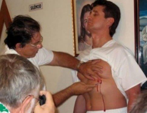 <b>Eliyle ameliyat ediyor:</b> Joao Teixeria da Faria Joao Teixeria da Faria, kendi bedenini kullanarak tbbi cerrahi ve psiik ifa uygulayan bedensiz varlklarla birlikte mucizevi sonular elde ediyor. Herkesin kendisine Tanr'nn John'u olarak da hitap ettii Joao Teixeria da Faria gnmzn yaayan en gl 'uur-d' medyumu ve belki de son 2000 yln en ok tannan ifacs..Son 40 yl iinde dorudan ya da dolayl olarak tedavi ettii hasta saysnn 15 milyon olduu tahmin ediliyor. Joao, bakent Brasilia'ya 130 km mesafedeki Goias'n Abadiania kasabasnda yer alan kk hastane tarzndaki mabedinde hastalarn cretsiz olarak tedavi ediyor.