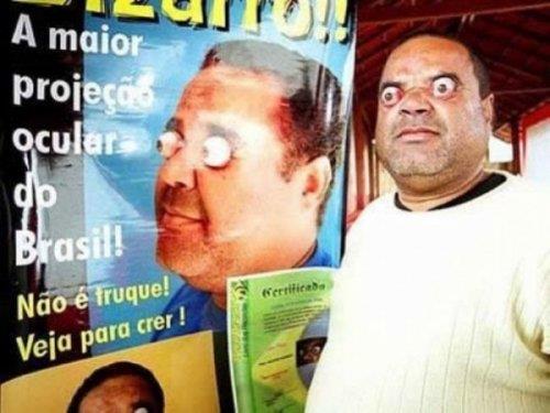 <b>Gzlerini yuvalarndan karan adam:</b> Claudio Pinto Claudio Pinto gzlerini yuvalarndan 4 cm darya karabiliyor. Dnya rekorunu krmay hedefleyen Pinto eitli salk testleri oluyor ve doktorlar daha nce hi gzlerini yuvalarndan bu kadar dar karabilen birini grmediklerini sylyorlar. Belo Horizonte'de yaayan Claudio Pinto bu zelliini para kazanmak iin kullandn syledi