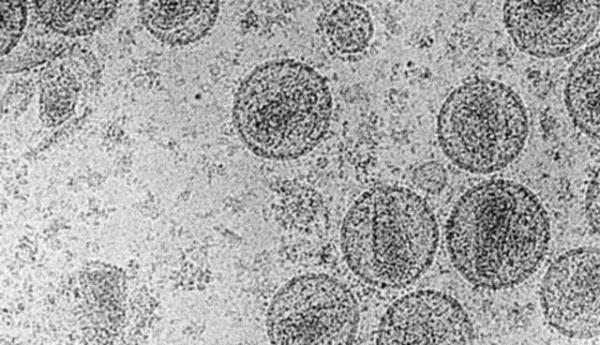 <p><b>AIDS, LABORATUAR ORTAMINDA YARATILDI:</b></p>   Doktor William Campbell'in teorilerine dayal olarak, birok kii HIV virsnn 1974 ylnda Dnya Salk rgt tarafndan gelitirildiine inanyor. Kimileri, bu virsn gelitirilme nedeninin CIA ve KGB'nin dnya nfusunu azaltma abalar olduunu sylyor.