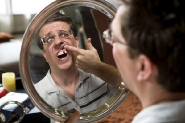 The Hangover filminde rol alan Ed Helms'in dii bilgisayar efekti ile yok edilmemiti, nk aktrn o dii zaten yoktu. Helms bir rportajnda 16 yandan beri o diinin yerinde implant olduunu sylemiti.