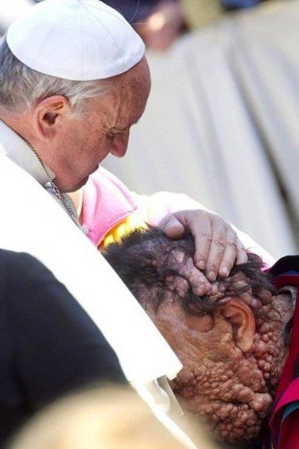 Papa Francis, nadir grlen fil hastal ile bouan bir adam teselli ederken