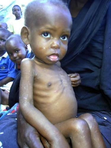 <p><b>Solomon Adalar</b></p>    Kii ba milli gelirin 600 dolar olduu Solomon adalar da kronik olarak alk ve fakirlikle ar karya.