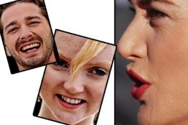 Gsteri dnyasnn nllerinin ok yakndan ekilen fotoraflar artyor. Bakalm nlleri ok yakn halleriyle tanyacak msnz?