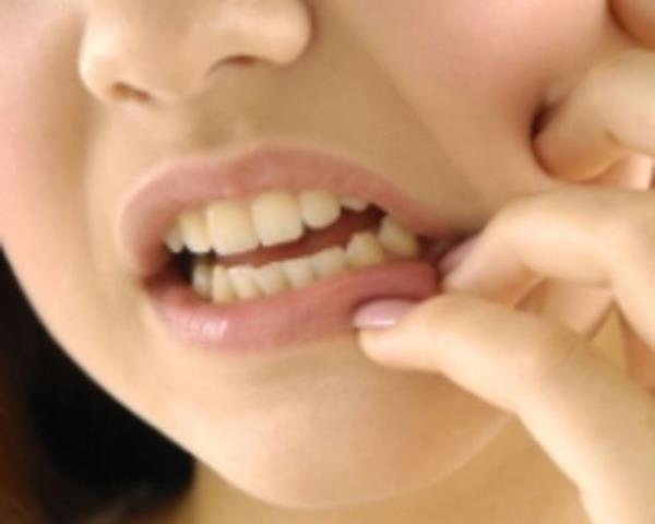 inde cva bulunan ve sala zararl olan amalgam dolguyu, Trkiye'deki di hekimlerinin yzde 75'i hala kullanyor.