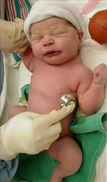 "Erken doum sonras solunum sknts ile yenidoan youn bakmda yatrlarak akcierleri gelitirici zel ilalar verilen ve solunum cihazna balanan bebeklerin ilk yalarnda geirilen enfeksiyonlar srasnda solunum sknts yineleyebiliyor.