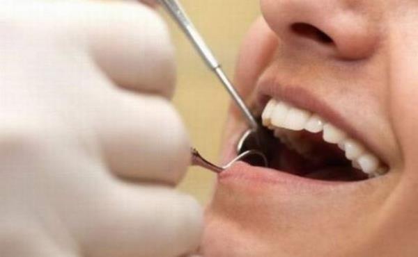 Dilin ierisinde kendiliinden oluan irili ufakl atlaklarn grnm haritaya benzer.