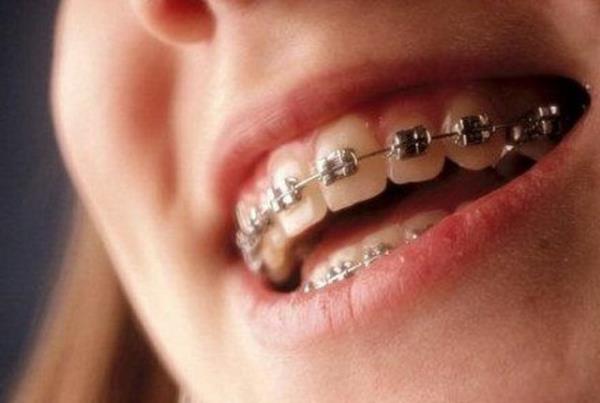 <b>Siyah Kll Dil</b>