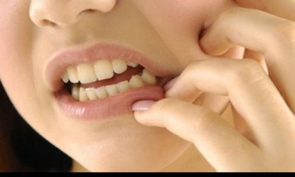 Periodontitis(ilerlemi di eti hastal)