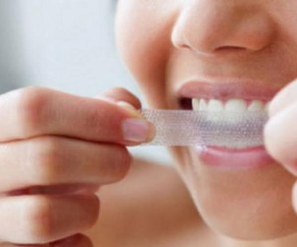 Kremden kahverengiye deien renklenme dil srtnda lokalize olur.