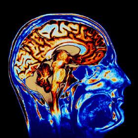 nsan beyin hcresi 5 takm Encyclopedia Britannicadaki bilgileri alabilecek kapasitededir.