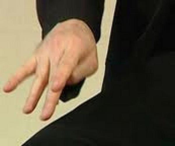 Ellerde titremenin duru ve harekete gre deiik tipleri vardr. Titreme istirahatte, hareket srasnda, yer ekimine kar duruta (eller ne uzatlm halde) veya bir olaya zel olarak (rnein; yaz yazma) ortaya kabilir.