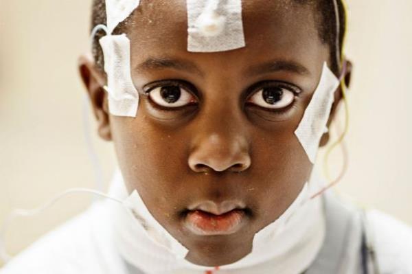 <p><b>Mart</b></p>  Washington'da Ulusal �ocuk Hastanesi'nde uykusunda a��r� horlayan 5 ya��ndaki Mason Brock taburcu ediliyor.