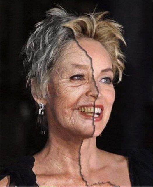 ngiliz Bilim Adam Aubrey De Grey, 2040'l yllarda %50 ihtimalle yalanmay durdurmay bulmu olacaz diyor.