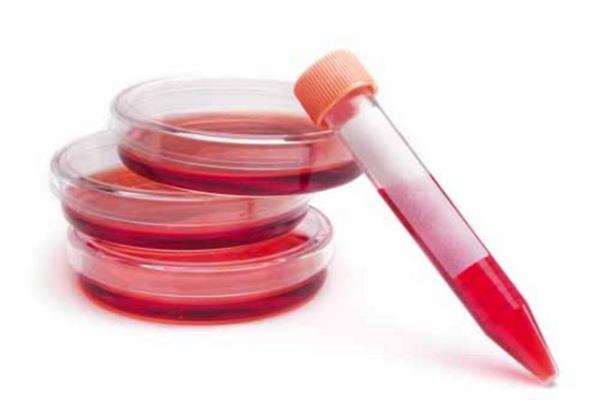 Vejetaryenler, yallar, devaml diyet yapanlar da B12 eksiklii riskiyle kar karyadr.