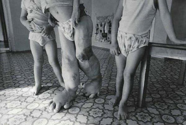 3 milyondan fazla kaytl insan ernobil kurbandr.