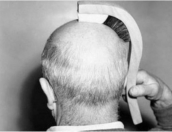 Kel insanlar iin fra