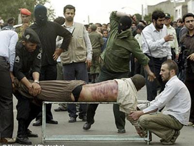 <b> Krbalama </b> Krbalama, kamlama veya dvme gibi cezalarda sulu krba, kemer veya ktek ile dvlr. ou lke bu tr cezalar yasaklamken, ran, Afganistan, Suudi Arabistan, Sudan, Singapur, Yemen, Malezya, Birleik Arap Emirlikleri, Bahamalar, Libya ve Nijerya'nn belli kesimleri gibi yerler bu yntemlere bavuranlar arasnda. Amerikan hapishanelerinde dzeni salamak iin gayri resmi bir ekilde dayak ve krba cezas uygulanyor.