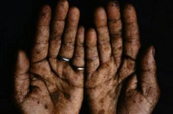 <p><b>Arsenik</b></p>  Eski zamanlarda arsenik her zaman katillerin favori seimi olmutur. Ayrca cinayet hikayelerinde en ok kullanlan zehirlerden biridir. ngiltere'de arsenik zehiri fare istilalarn nlemek isteyenler iin eczanelerde satlmaktadr.