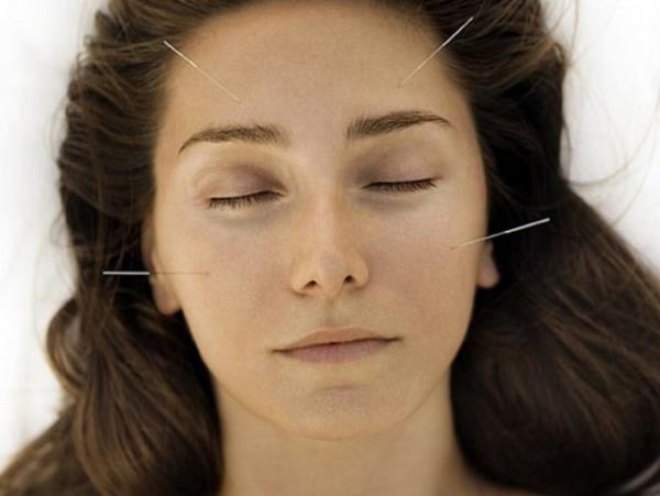 Akapunktur (in) - Ba arsna birebir zm olarak kullanlyor