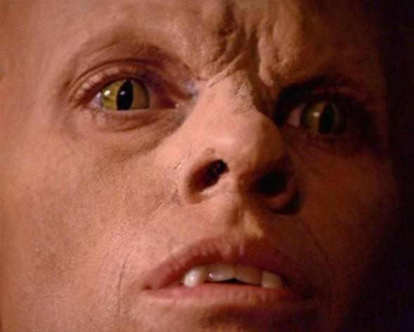 te plastik makyajla klktan kla giren yldzlar...