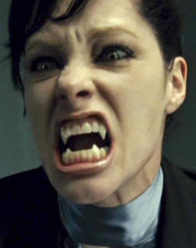 te plastik makyajla klktan kla giren yldzlar...