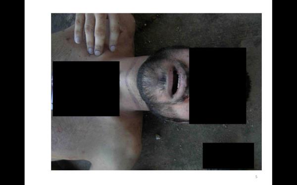 Cesetlerin y�z ve bedenleri �zerine elle yaz�lan �ifreli notlarla beraber �ekilen bu foto�raflar, Suriye ordusu i�inde sistematik olarak verilen �ld�rme emirlerinin yerine getirildi�ine dair belge olarak kabul g�rd�.