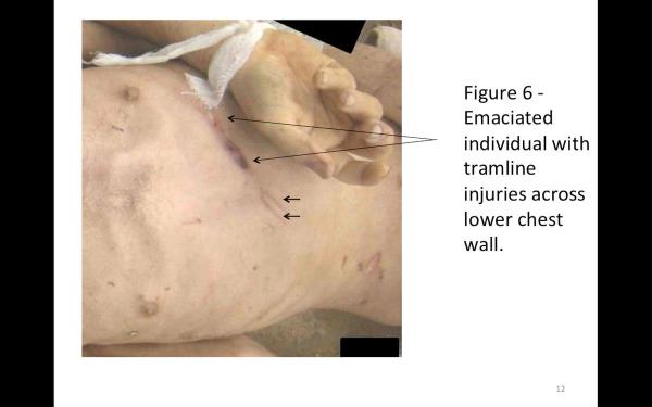 Foto�raflar�n ve di�er g�r�nt�lerin ger�ek olup olmad��� ve �zerlerinde oynama yap�l�p yap�lmad��� konular� �ngiltere’de bir laboratuvarda incelendi. �ncelenen  materyallerin  t�m�n�n m�dahale edilmeyen ger�ek foto�raflar oldu�u tespit edildi.