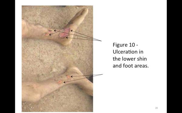 "Caesar" 13 y�l boyunca Suriye ordusunda askeri polis olarak �al��t�. G�revi adi su� vakalar� ve kazalarla ilgili foto�raf �ekmek ve bunlar� "yarg�ya" yollamakt�. Olay yeri inceleme ekibinin bir �yesiydi.   "Caesar" Komisyon'a, "�� sava��n ��kmas�ndan sonra g�revim olay yeri ve kaza foto�raf� �ekmekten, �ld�r�len tutuklular�n resmini �ekmeye d�n��t�" dedi. "Caesar" ve �al��ma arkada�lar� 2 y�l boyunca �ld�r�len tutuklular�n cesetlerinin foto�raf�n� �ekip belgeledi ve �stlerine g�nderdi.
