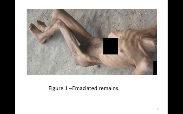 Anadolu Ajans�, Suriye'de Esed rejimi taraf�ndan i�lenen sava� su�lar�n� belgeleyen rapor ve foto�raflara ula�t�. Uluslararas� sava� su�lar� komisyonu, Suriye lideri Be��ar Esed g��lerinin sistematik i�kence ile katliam yapt���na ili�kin delillere ula�t�. Foto�raflar� �ngiltere'de incelettiren komisyon, resimlerle bir oynama olmad���n�, <b>ger�ek oldu�unu duyurdu.</b>