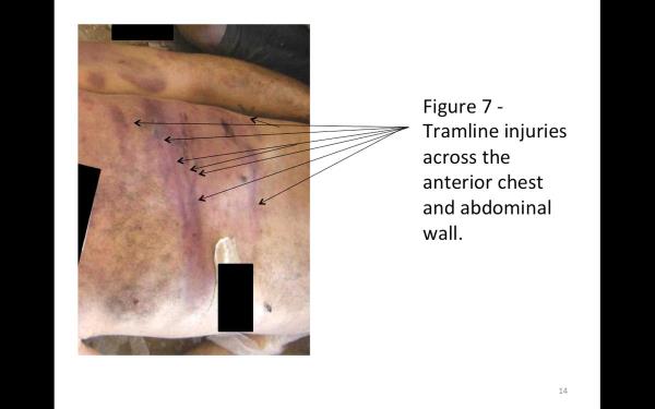 Dikkat �eken bir di�er �nemli tespit de a�l���n bir i�kence y�ntemi olarak kullan�lmas� oldu. Komisyon, bu y�ntemlerle �ld�r�len ve 55 bin kare foto�raf� �ekilen ki�i say�s�n�n yakla��k 11 bin oldu�u tahmininde bulundu.