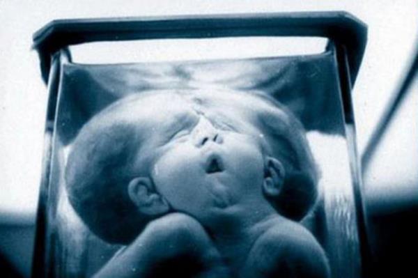 Mzenin en nadide paras ise gmld yerde sabuna dnen bir kadn cesedi ve 2 kafal bir ocuk iskeleti...