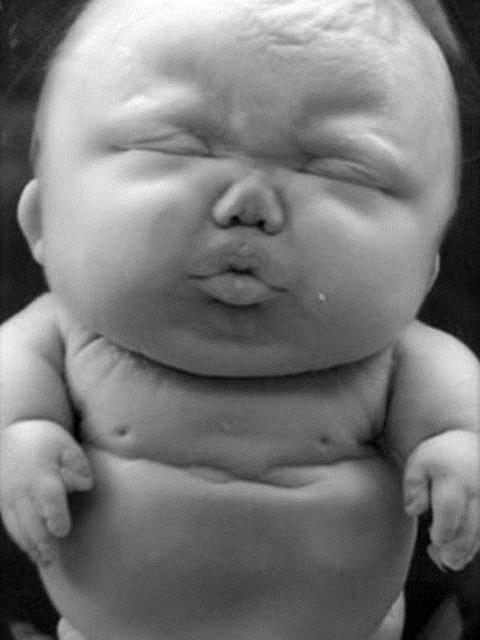 ABD'nin Philadelphia eyaletinde kurulan Mutter Mzesi, dnyann en korkulan yerlerinden biri olarak gsteriliyor