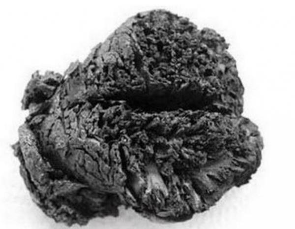 Bugne kadar bulunan en eski insan beyni. Yaklak 4000 bin yllk