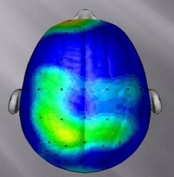 Otururken beyin aktivitemiz.