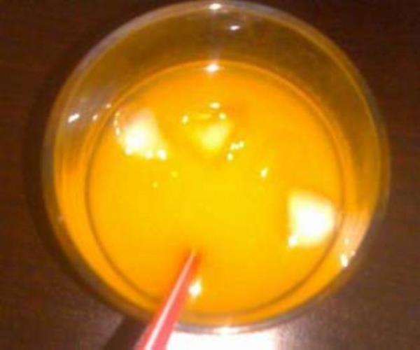 16. ALKOLL ECEK: Alkol kullanm beyin ve sinir sistemini olumsuz ynde etkiliyor.