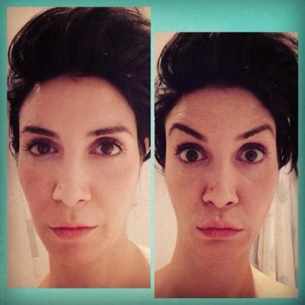 AHU YATU nce sonra kendinden botokslu