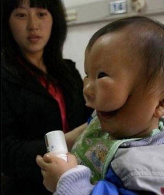 Doktorlar Kangkang'n yznn neden byle olduunun sebebini henz bulamad.