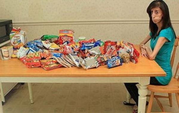 ok nadir grlen bu hastalk onu zayf tutuyor ve yedikleri hi kiloya dnmyor. Ancak normal bir insan gibi gnde 3 n yerse hayatta kalamayacak.