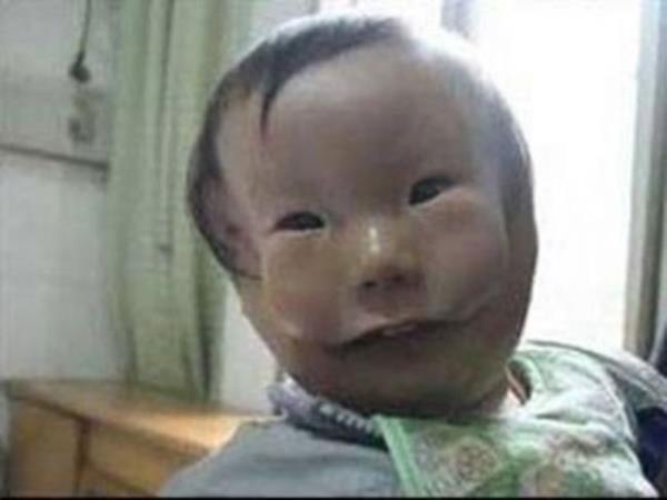 Tedavisinin ile ok pahal olduu syleniyor. Neyse ki ailesi gerekli paray buldu ve Kangkang'n ameliyatn gerekleti.